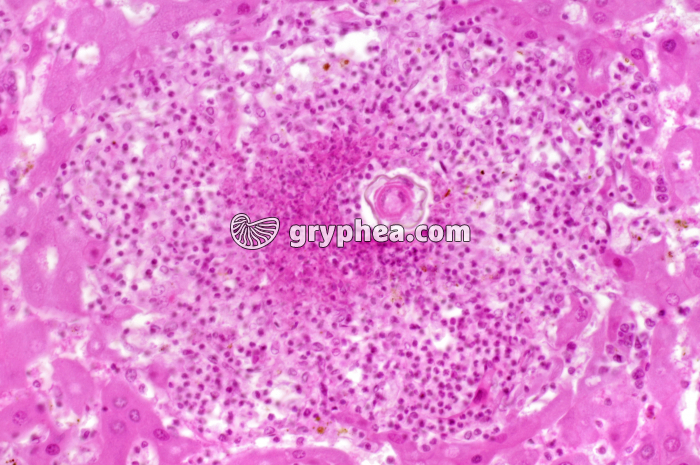 Schistosome - ver parasite (Schistosoma mansoni ) - foie de mammifère x100 - gryphea.org